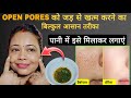 कितना भी पुराना OPEN PORES/ LARGE PORES हो बस पानी में ये मिलाकर लगाएं 100% छुटकारा पाएं