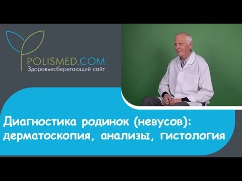 Диагностика родинок (невусов): дерматоскопия, анализы, гистология