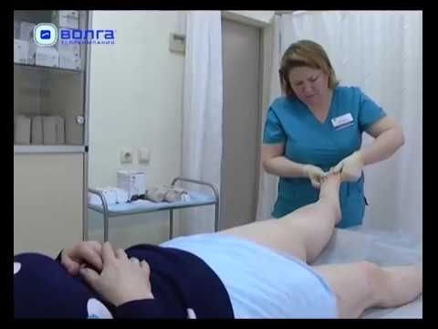 Комплексное лечение лимфедемы нижних конечностей