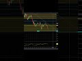“🔥 $1600 Short + $465 Long | All in 1 Trade Inside the Zone Box