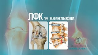 Лечебная физкультура и реабилитация при заболевании ОДА. Г.Владивосток