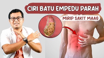 TANDA SAKIT BATU EMPEDU YANG PARAH - DOKTER SADDAM ISMAIL