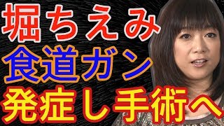 堀ちえみが食道がんをブログで公表?ガン体質の原因はタバコ?舌癌が転移したのか?- 事故ニュース