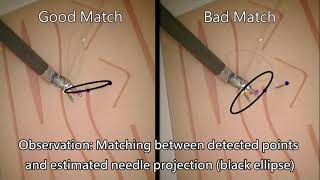 Markerless Suture Needle 6D Pose Tracking for Autonomous Minimally Invasive Robotic Surgery