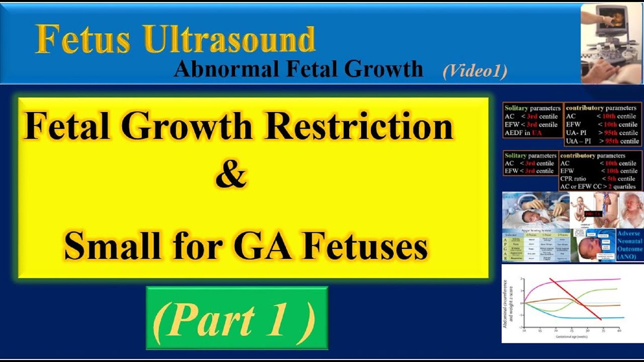 Fetal Growth Restriction Treatment
