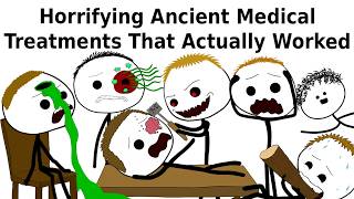 Horrifying ancient medical treatments that actually worked