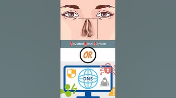 WHAT IS DNS? #programmingquiz #networking #quiz