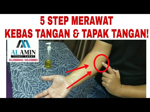 Video: 3 Cara Mengambil Minyak CBD untuk Carpal Tunnel