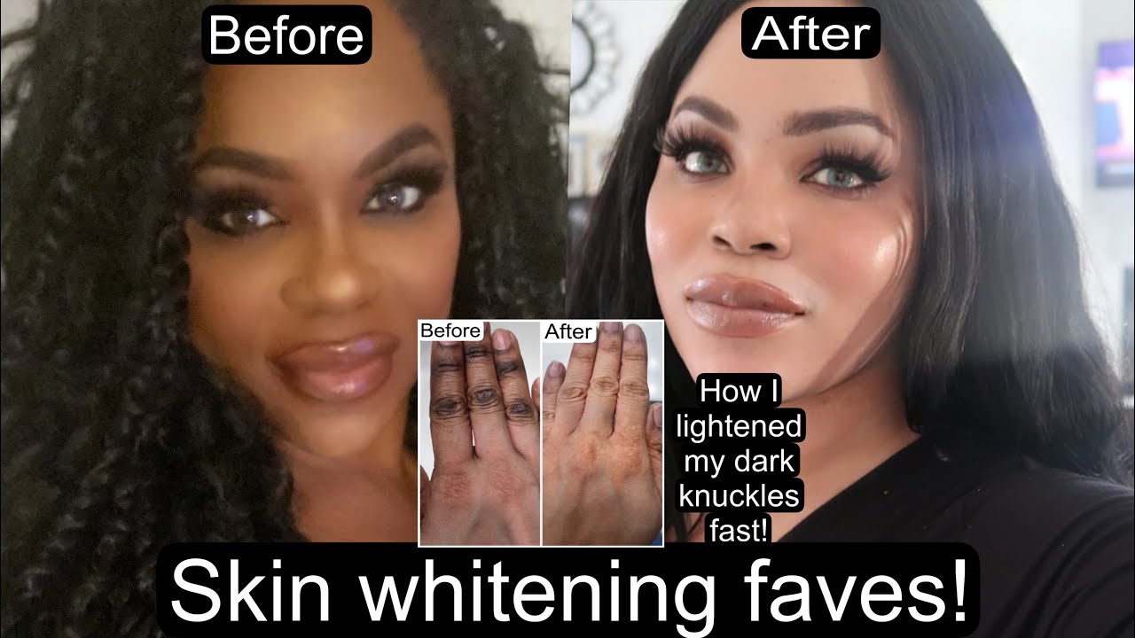 Skin Whitening Regimen How I lightened My Dark Knuckles Fast!!! YouTube