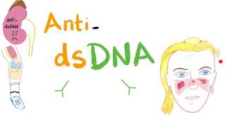 Antidouble Stranded DNA (AntidsDNA) Antibodies