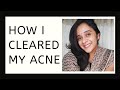 മുഖക്കുരു മാറ്റാൻ ഞാൻ എന്തു ചെയ്തു | How i cleared my ACNE | How to get clear Skin | Anju Joseph