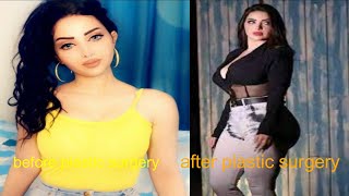 ريتا محمد قبل وبعد عمليات التجميل ، Iraqi model Rita Muhammad before and after plastic surgery