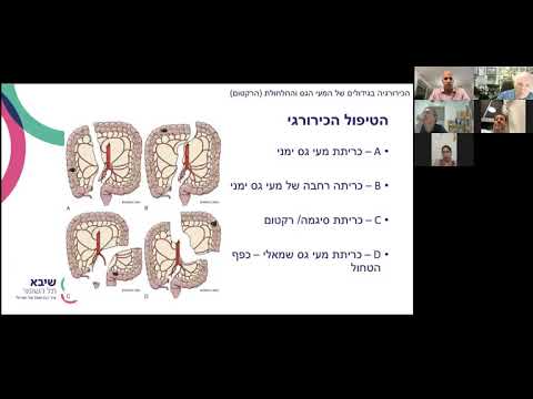 דר' אלמוג בן יעקב - מפגש בנושא ההיבט הכירורגי בגידולים של המעי הגס והרקטום