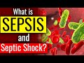 Understanding Sepsis and Septic Shock