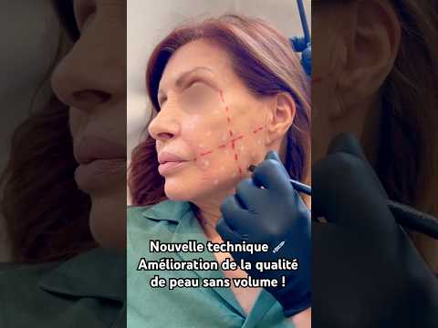 Естественное сияние и лучистая кожа: техника без увеличения объема, которая меняет все 💧