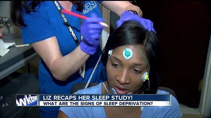 What does sleep deprivation look like in kids?