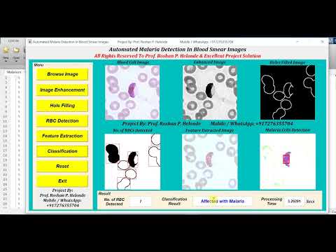 Malaria Detection From Blood Images Using Image Processing IEEE Based Projects