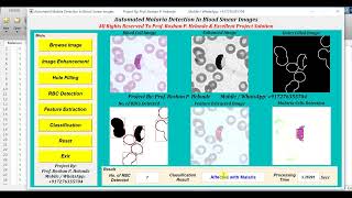 Malaria Detection From Blood Images Using Image Processing IEEE Based Projects