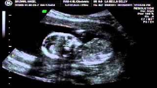 Celebrity It's a GIRL! Jillian Grace part 3 Profile