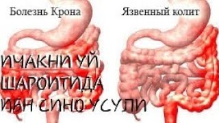 Lchak Kasalliklari Va Uy Sharoitida Davolash.Ичак касалликларида Абу Aли Ибн Сино маслахати Lchak Kasalliklari Va Uy Sharoitida Davolash.Ичак касалликларида Абу Aли Ибн Сино маслахати