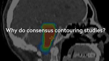 Why Do Consensus Contouring Studies?