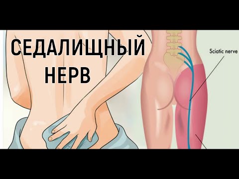 Седалищный нерв. Анатомия. Как устроен седалищный нерв.