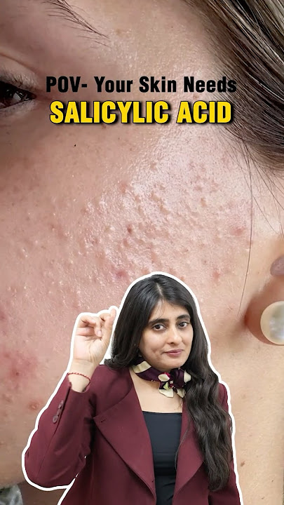 Salicylic acid serum | What salicylic acid can really do for acne and Comedones