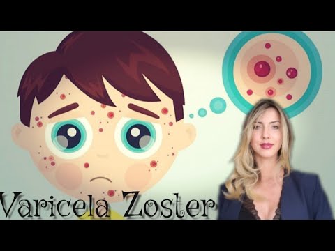 Video: Te Poate Ucide Zosterul? Pericolele Complicațiilor