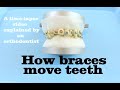 How braces move teeth (time-lapse) - Braces Explained!