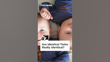 Are Identical Twins Really Identical?
