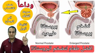 افضل فيتامين لتضخم البروستاتا الحميد | افضل طعام ملعقه واحده يوميا تشفي تعالج مشاكل البروستاتا!