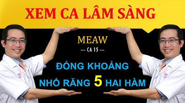 Ca 16 - MEAW - Đóng khoảng trong ca nhổ răng 5 hai hàm