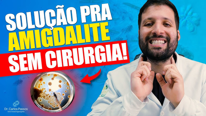 Dr.Consulta, estou com bolinhas brancas na garganta