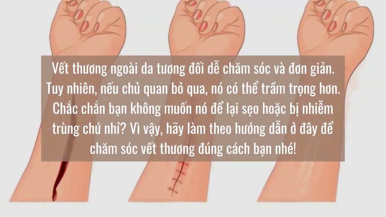 Bí Mật Phía Sau Quá Trình Lành Thương Ngoài Da - Khám Phá Sự Hồi Phục Tuyệt Vời Của Làn Da