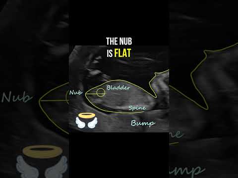 Gender Reveal With NubX