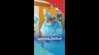 استئصال ورم حميد  - الدكتور مرتضى فيصل