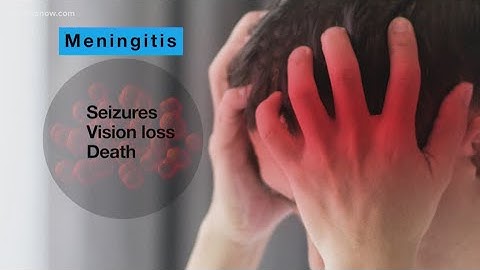 VDH issues new alert about meningitis spread in Eastern Virginia