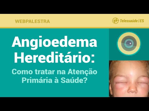 Vídeo: Angioedema Hereditário: Sinais E Sintomas De Alerta Precoce