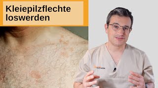 Kleiepilzflechte loswerden (Schwitzpilz, Pityriasis versicolor behandeln) Dr. Kasten, Mainz