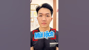 MŨI LỆCH nguy hiểm như thế nào? #matlech #nanmat #hungtrilieu