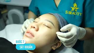 Quy trình nặn mụn chuẩn y khoa nhà S Beauty | Dr Hưng S Beauty