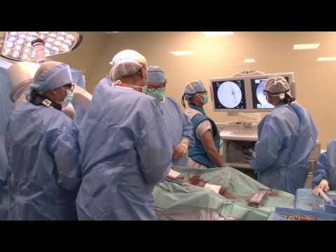 Eндоваскуларно лечение на аневризми на аортата (EVAR) в Болница „Тракия“