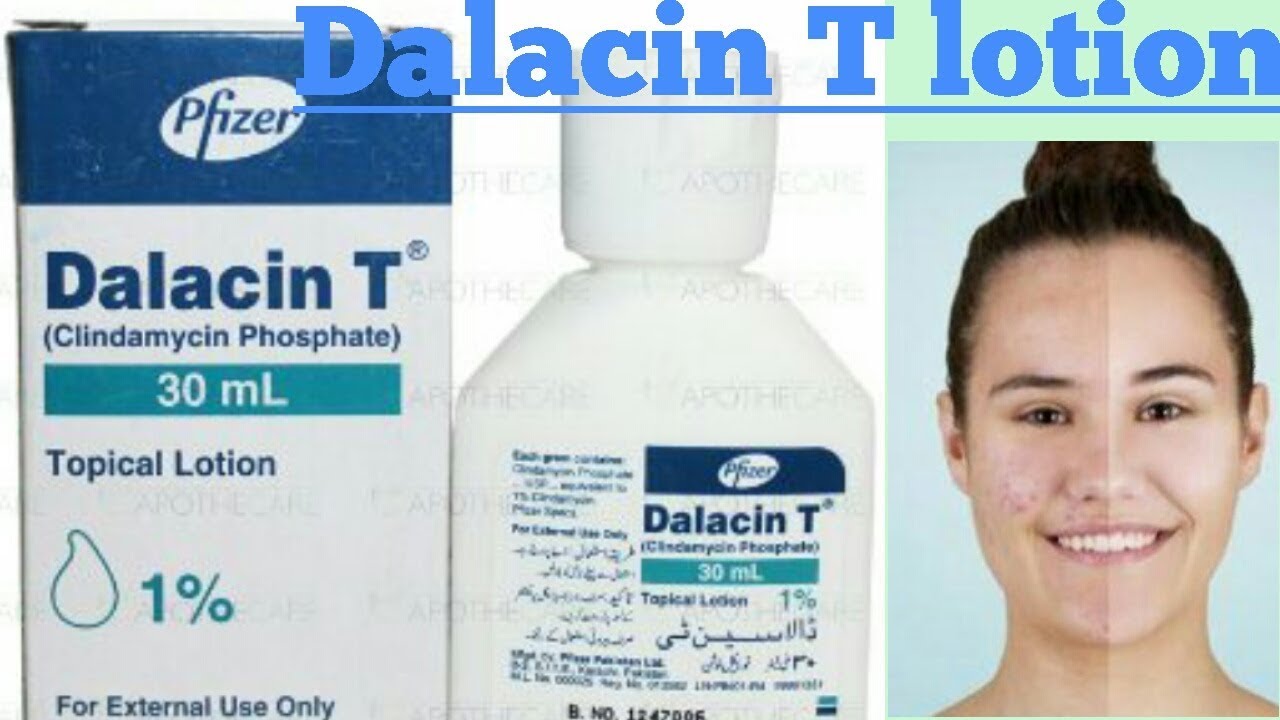 Dalacin T lotion - YouTube
