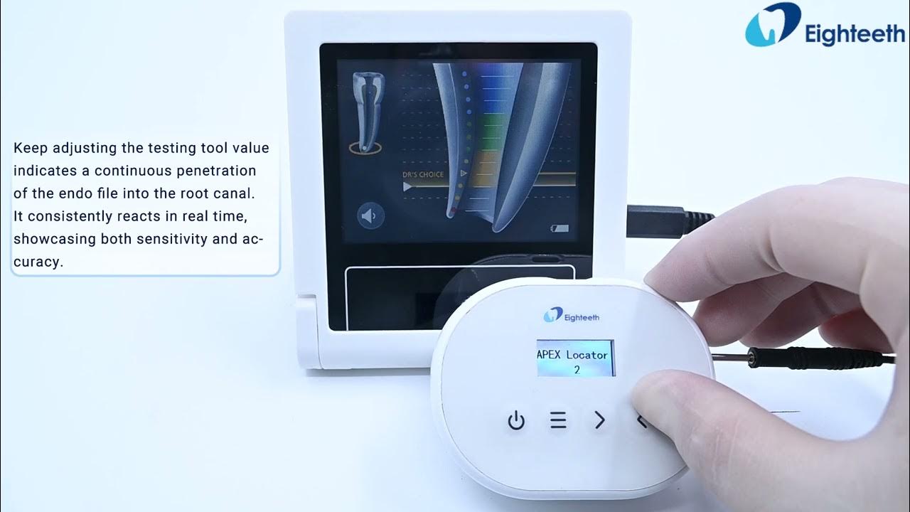 Apex Locator Comparison FindPex vs. One of the industry benchmarks
