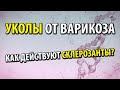 Уколы от варикоза (склеротерапия). Как действуют склерозанты. Возможные осложнения