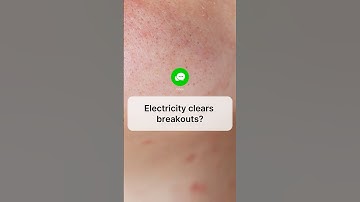 LED Mask vs ZIIP Dot for Acne? Why Microcurrent May Be Better for Pigmentation-Prone Skin!