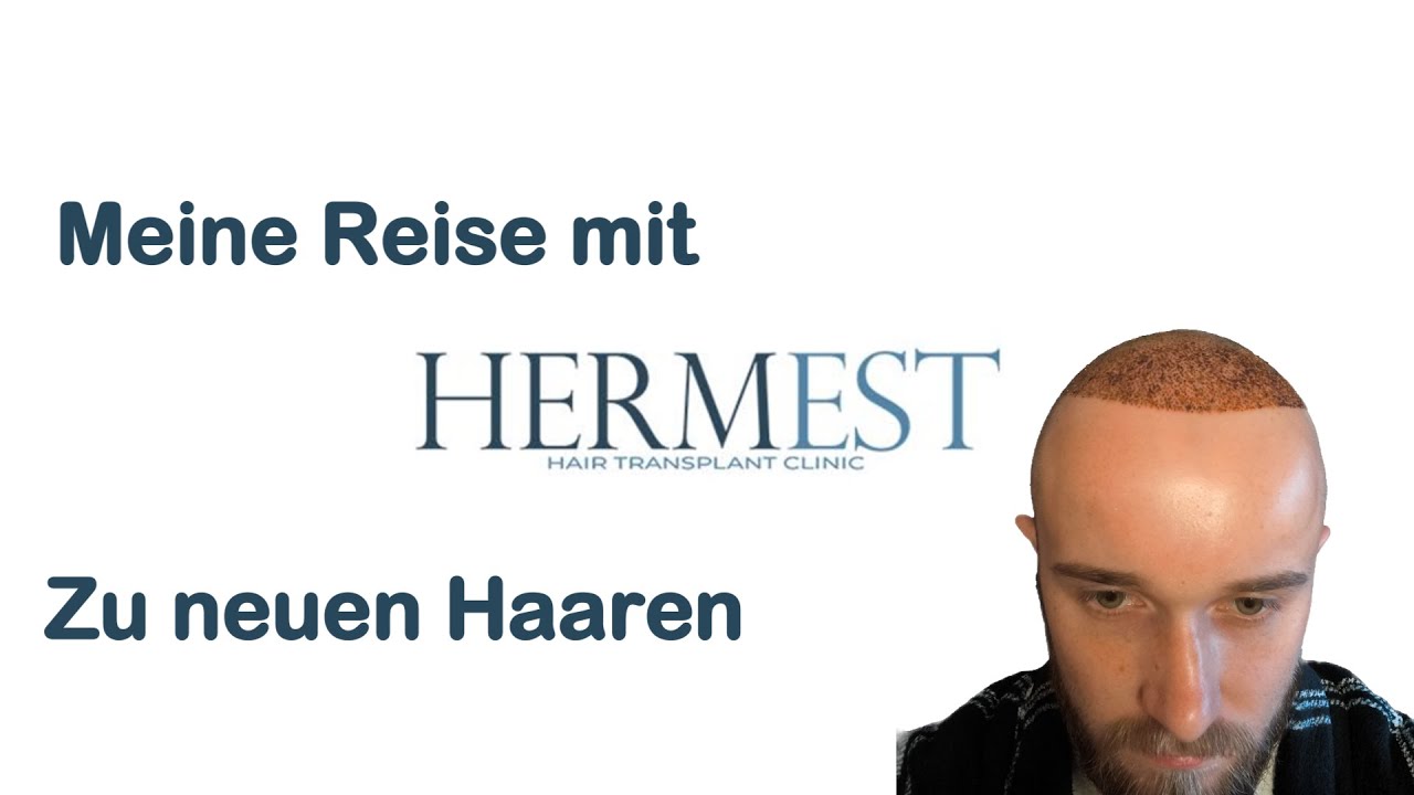 Meine Haartransplantation in der Türkei | Der Monat danach | Hermest Hair Clinic Istanbul