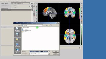NeuroElf - surface visualization