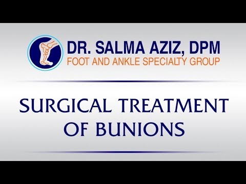 Surgical Treatment for Bunions by Dr Salma Aziz at Foot and Ankle Specialty Group in Orange County