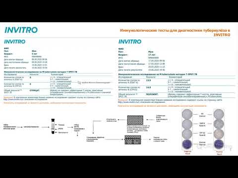T-SPOT, Квантифероновый тест. Современная лабораторная диагностика туберкулёза.